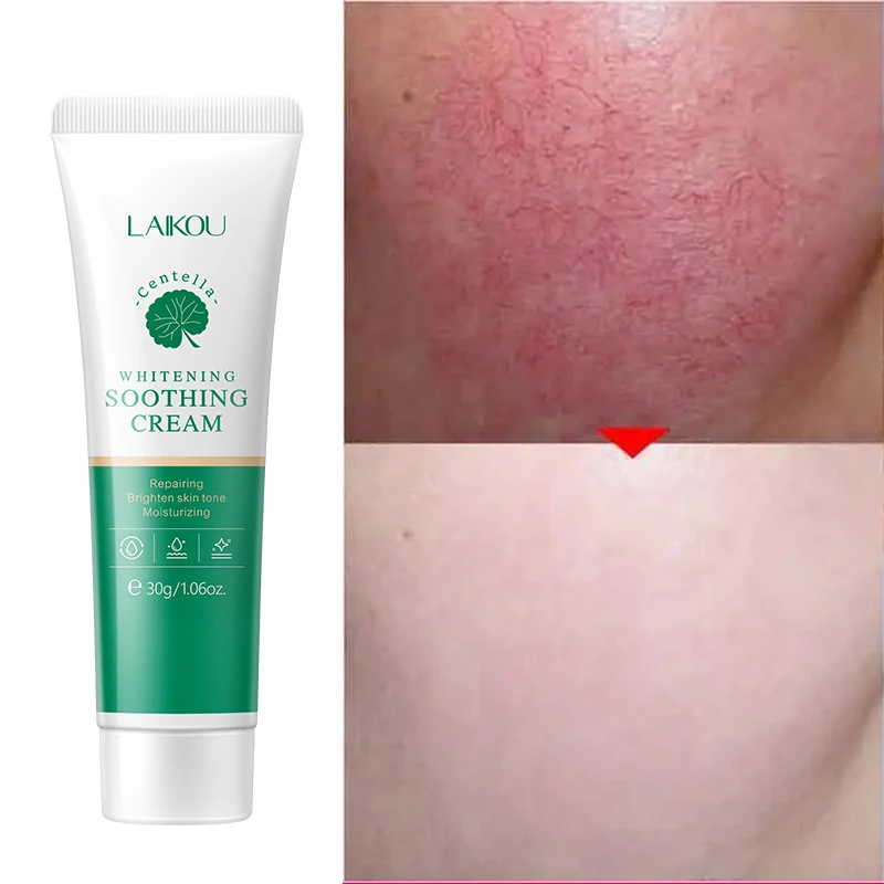 Effective Treatment Face Redness Cream Repair Nourish Sensitive Skin Care Improve Acne Fade Acne Scars Whitening Korea Cosmetic