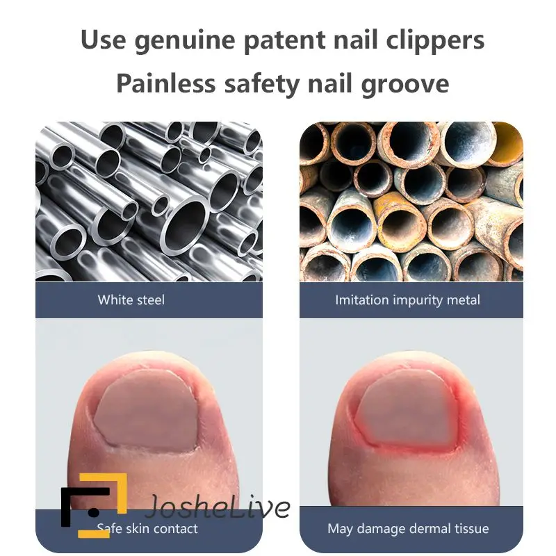 

Stainless Steel Nail Clippers Pedicure Artifact Nail Groove Professional Nail Art Nail Scissors Toenails Scissors