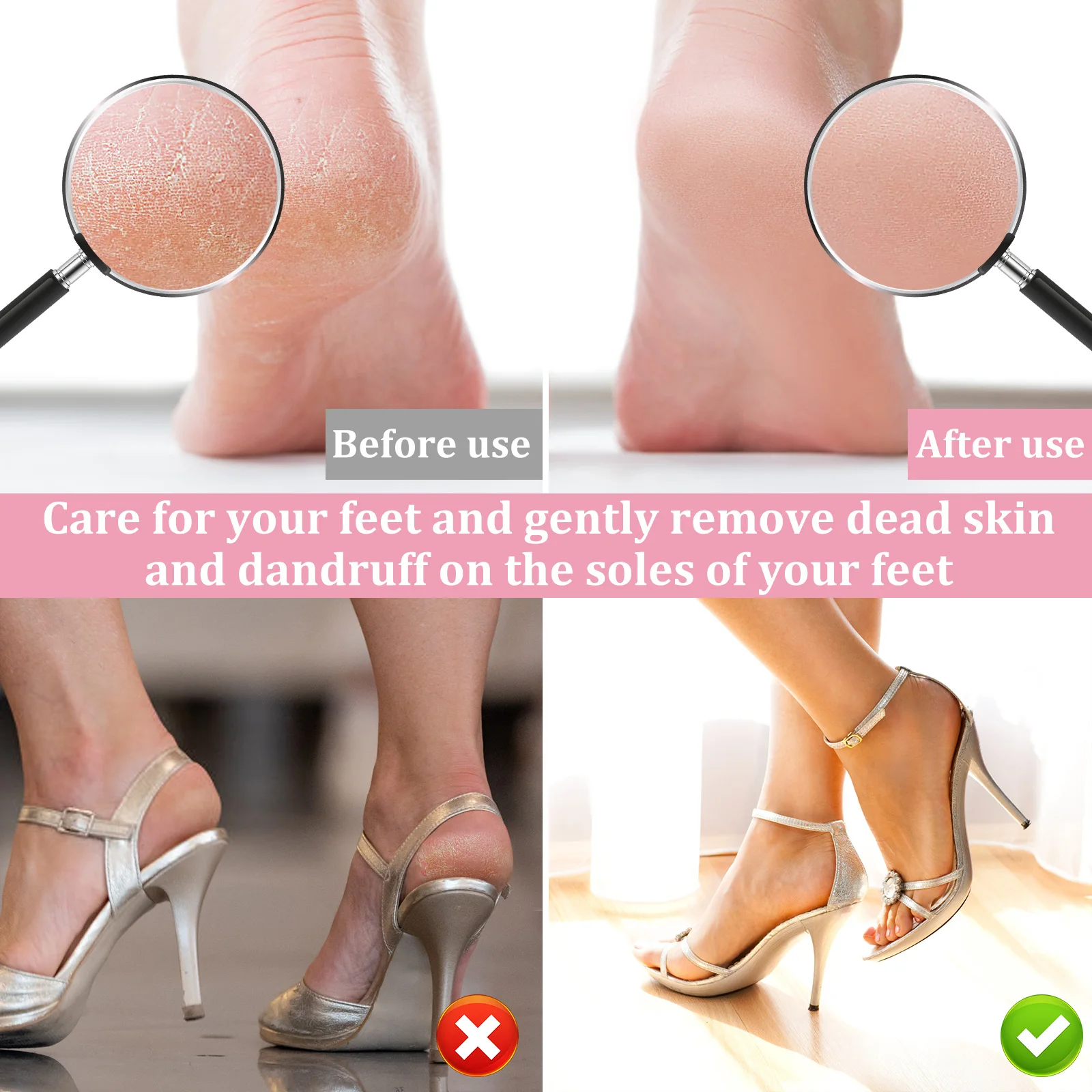 Rechargeable Aluminum Foot File Callus Remover with Adjustable Speed