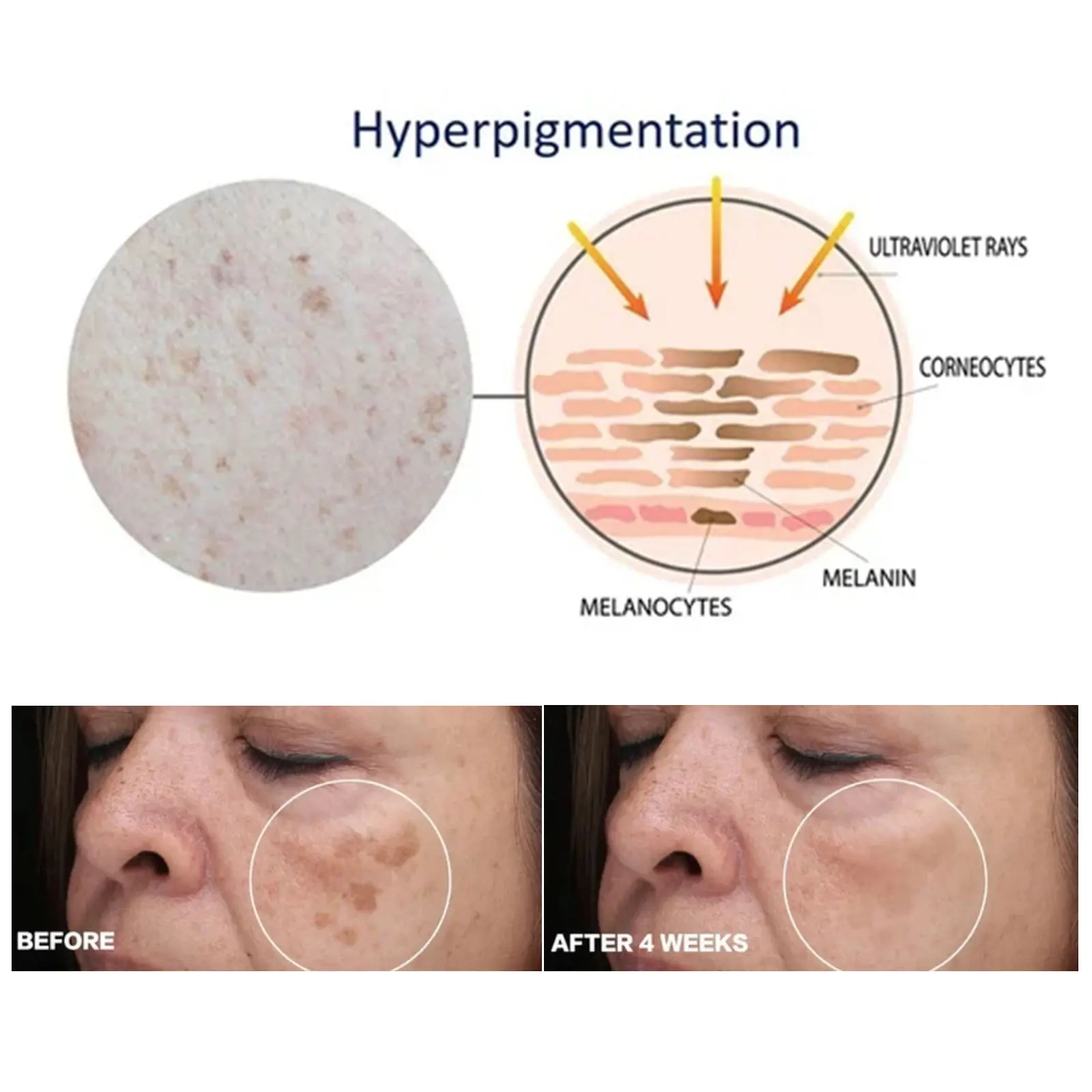 Turmeric Serum Dark Spots Corrector Melasma Pigmentation Removal Lighten Brighten Melanin Anti Aging Face Whitening Essence Care_voghion.com