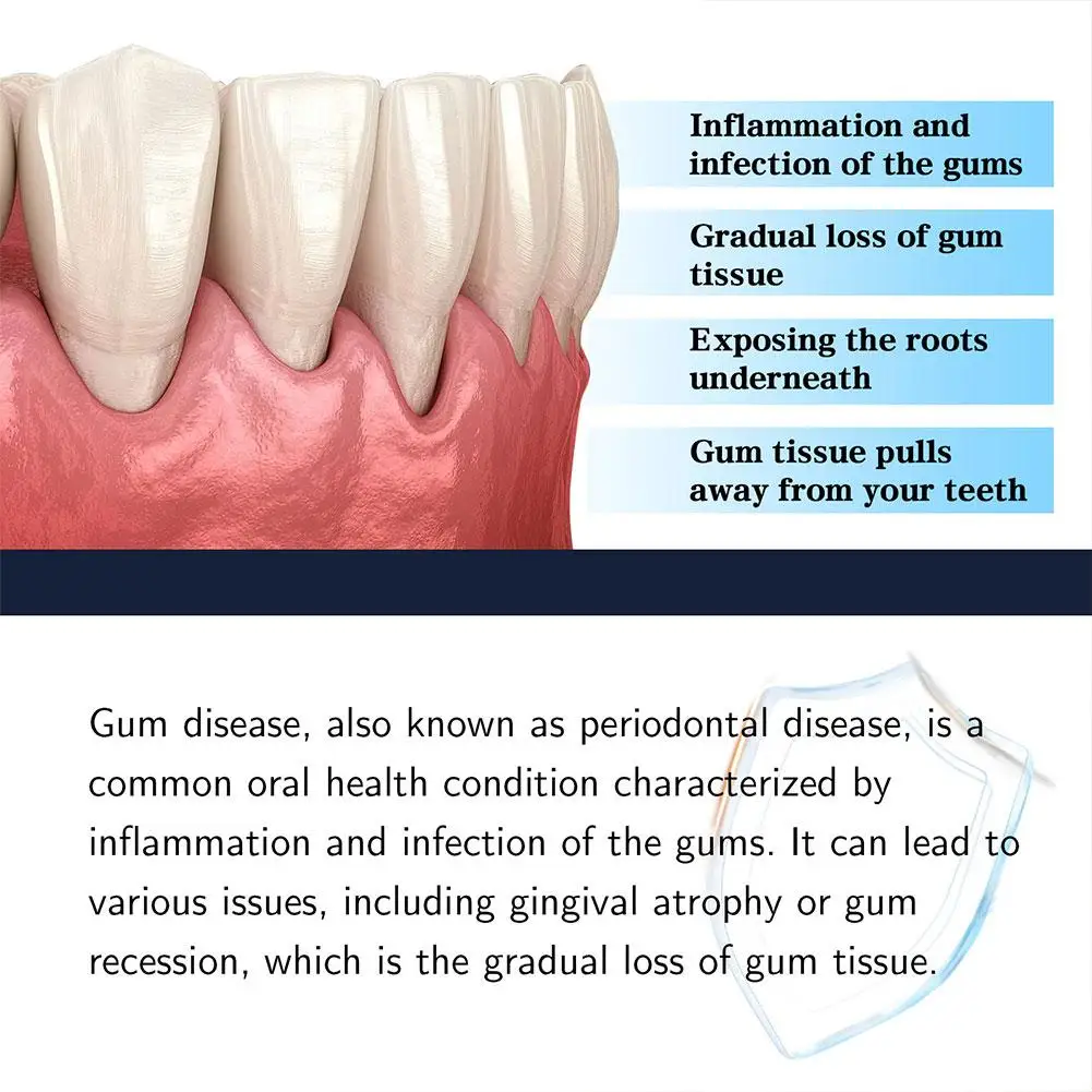 Gum Repair Solution Drops Deep Clean Bright White Teeth Gum Halitosis Solution Cleaning Gums Swollen Oral Care Treatment Ca S6M9