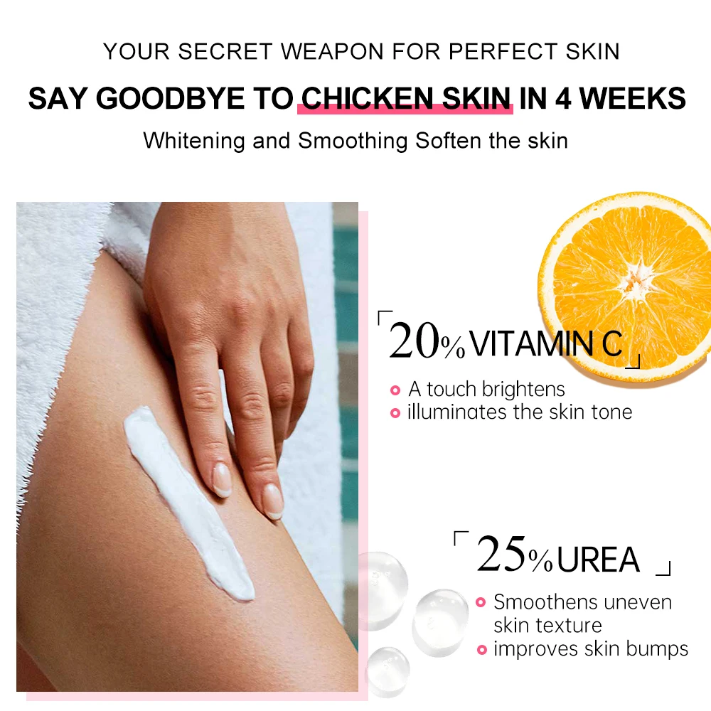 JoyPretty Chicken Remover Skin Care Body Cream Keratosis Pilaris Treatment Skin Repair Body Lotion Moisturizing Whiten Body Care 6