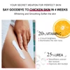 JoyPretty Chicken Remover Skin Care Body Cream Keratosis Pilaris Treatment Skin Repair Body Lotion Moisturizing Whiten Body Care 6