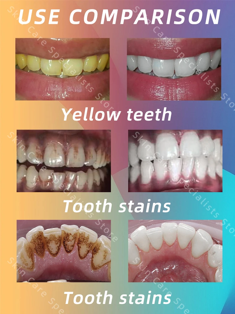 Рисунок 6 - Средство для удаления пятен с зубов