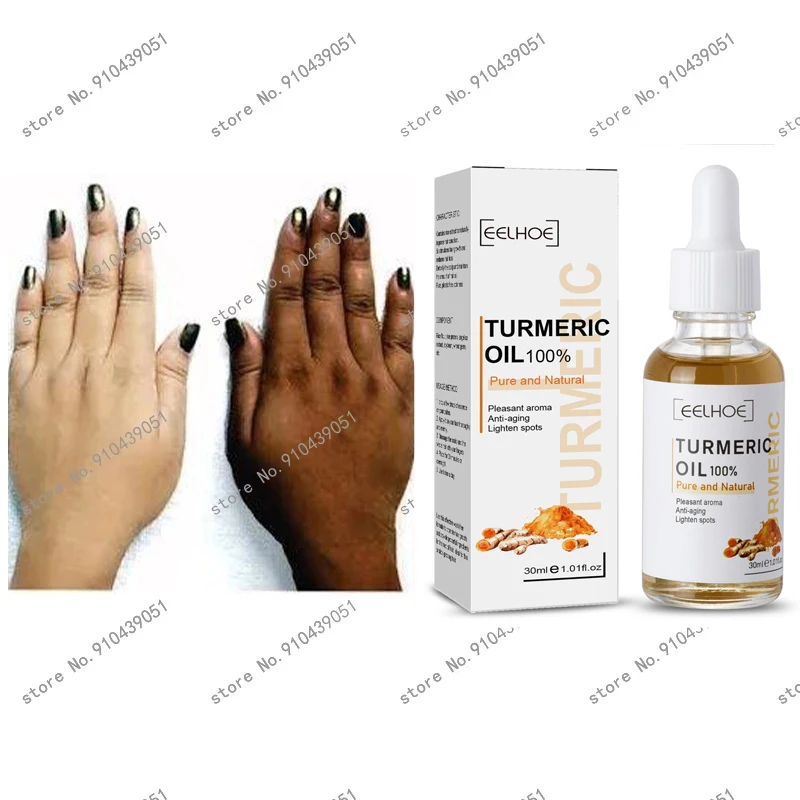 Turmeric Lemon Oil Skin Glow To Lightening Acne Dark Patches, Acne
