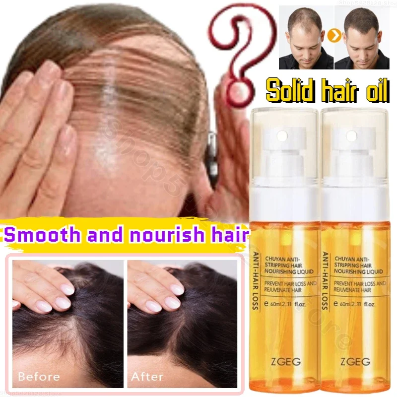 

ZGEG Hair Restoring Liquid Softens Hair Refreshes and Fluffs It Nourishes Damaged Hair Follicles and PromotesGrowth 60ml