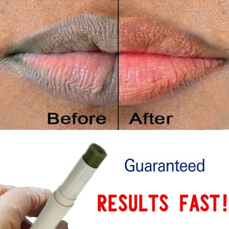 African hot sale Natural Green Plant Pink Fresh Lightening Lip Cream Treatment to Remove Dark Lips men and women Free shipping