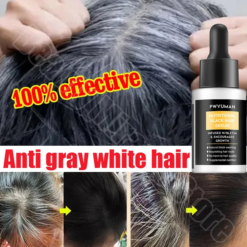 Gray White Hair Treatment Serum Fast White To Black Repair Natural Color Nourish Products Anti-grey Hair Care Beauty Health пульсоксиметр на палец jet health po 2 white