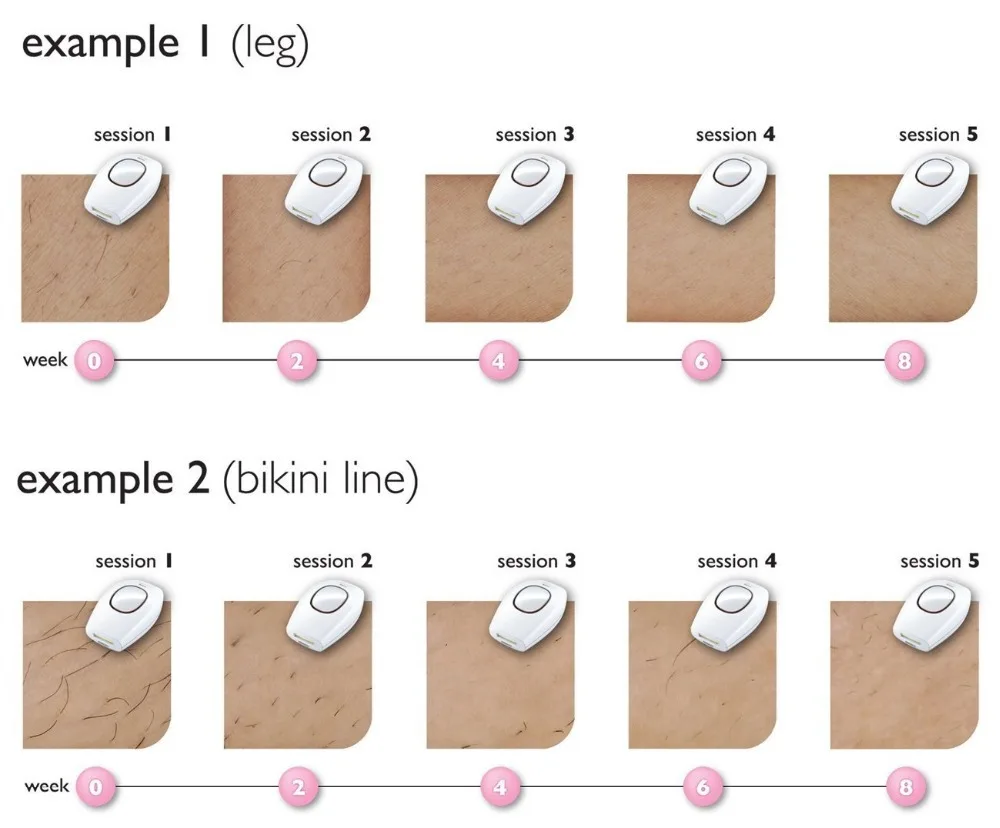 Xiaomi Pulse IPL Women's Epilator Body Pussy Bikini Laser Pulse Hair Removal Shaver Home Equipment R Epilator 500000 Flashes New 4