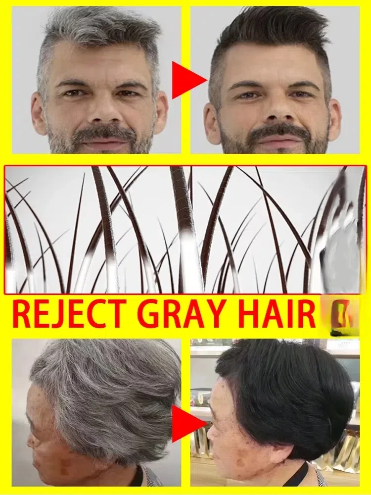 White hair killer remove gray hair and restore natural color in 7 days