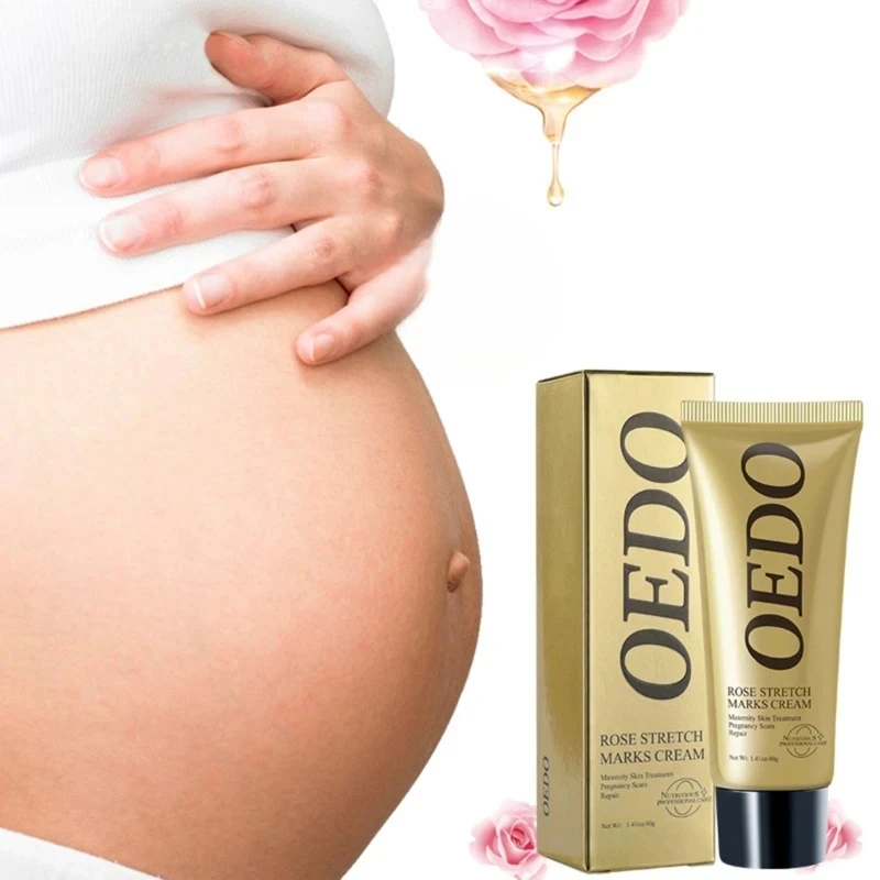 Removes Stretch Mark Cream To Remove Postpartum Obesity Pregnant Women Repair Anti-Aging Winkles Firming Body Cream Skin Care stretch marks cream