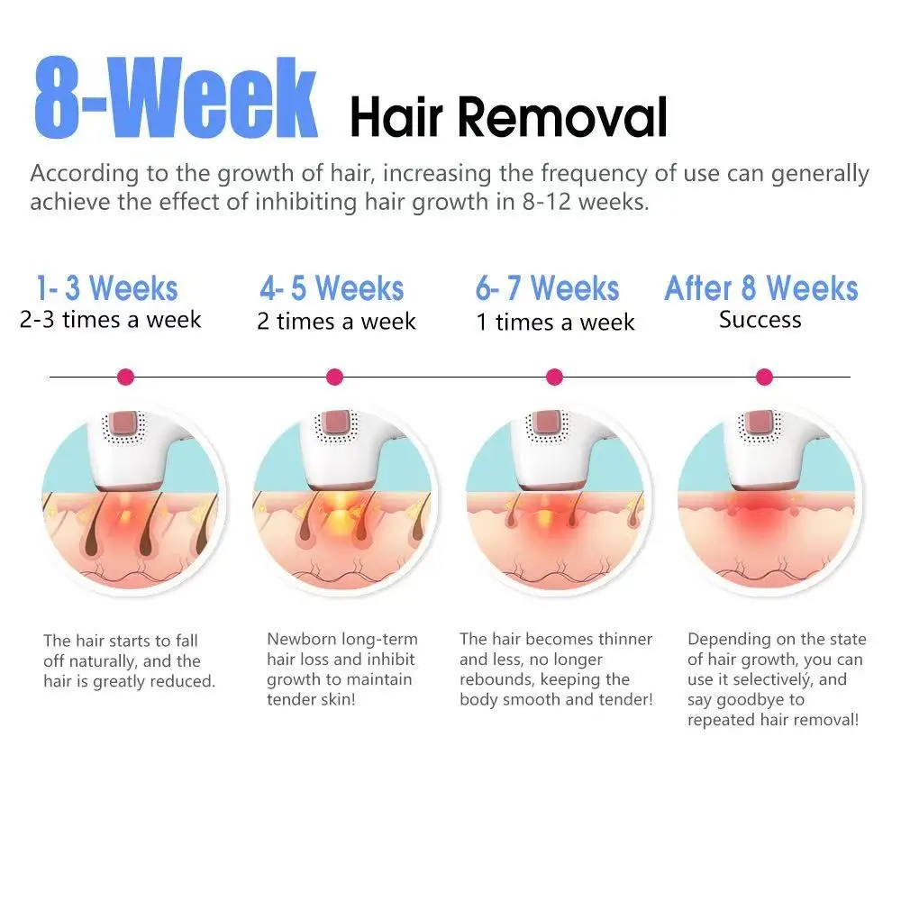 جهاز إزالة الشعر بالليزر IPL مع تبريد الثلج لإزالة...