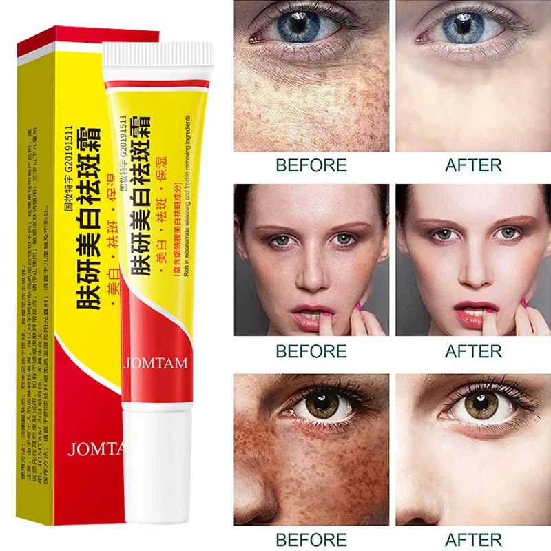 Face Brightening Cream Niacinamide Reduce Melasma Melanin Lighten Dark Skin Chloasma Serum Weaken Fine Lines Care niacinamide serum whitening body cream