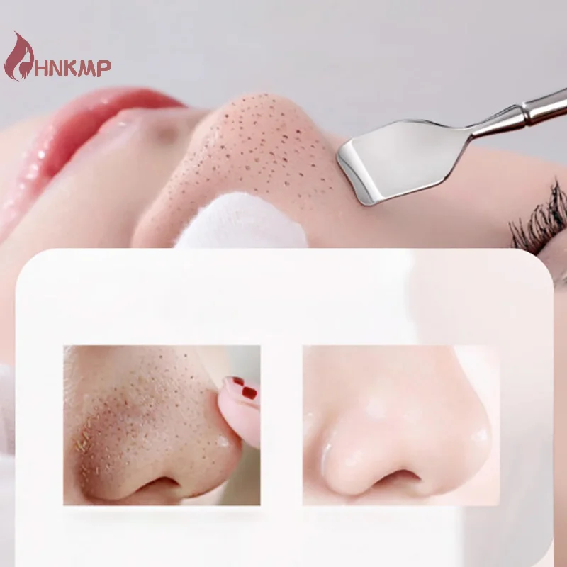 Two-sided Blackhead Remover Spatula Nose Face Blemish Pore Cleaner Beauty Face Health Salon Special Remover Acne Tool