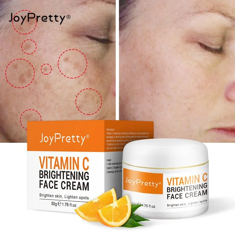 

Newest Vitamin C Whitening Facial Cream Repair Fade Freckles Remove Dark Spots Melanin Remover Brightening Face Cream