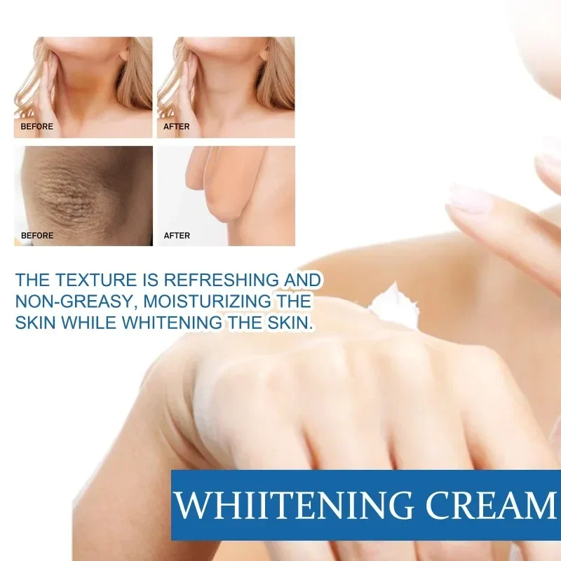 Skin whitening cream armpit Knee Neck removal dark Spots Melanin Bleaching Underarm Inner Thigh brighten moisturizing body care