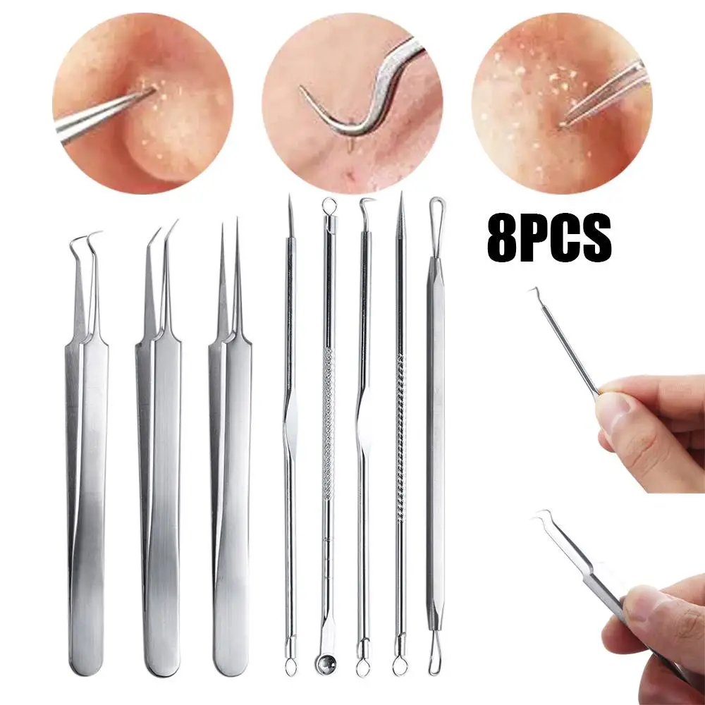 

Steel Tweezer Acne Pimple Extractor Facial Pore Cleaner Face Care Tool Pimple Removing Skin Care Tool Kit Blackhead Removing