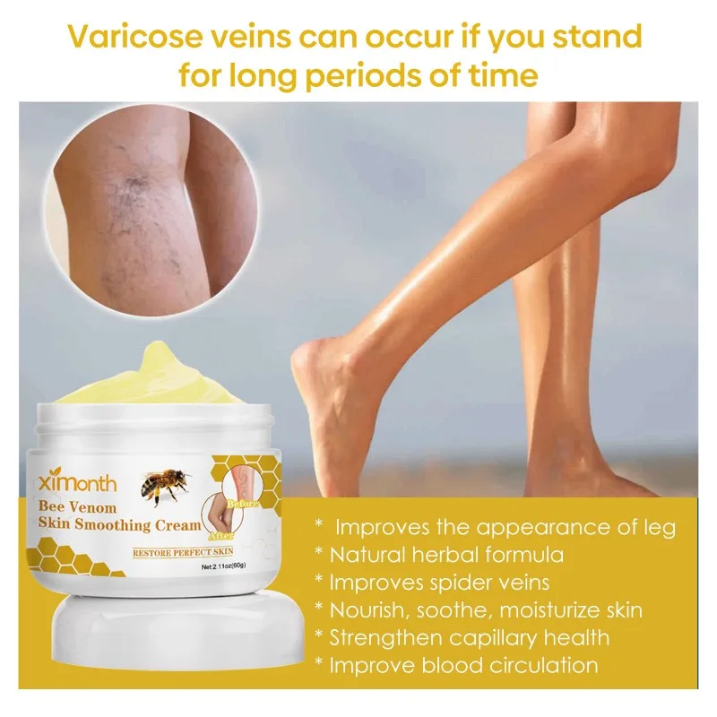 발톱무좀 Bee Venom Venous Repair Cream Relieves Leg Pain and Swelling Smoothes Vascular Protruding Veins Personal Health Care personal health care
