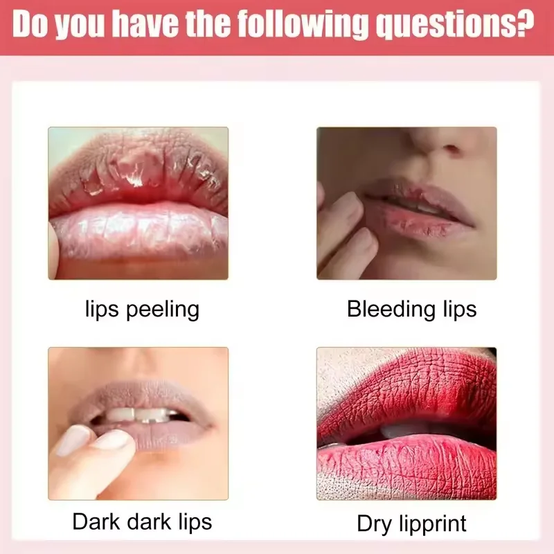 Lip Balm for Remove Dark Lip Dead Skin Removal Lip Lines Exfoliate Lasting Moisturizing and Nourishing for Men and Women Serum 3