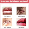 Lip Balm for Remove Dark Lip Dead Skin Removal Lip Lines Exfoliate Lasting Moisturizing and Nourishing for Men and Women Serum 3