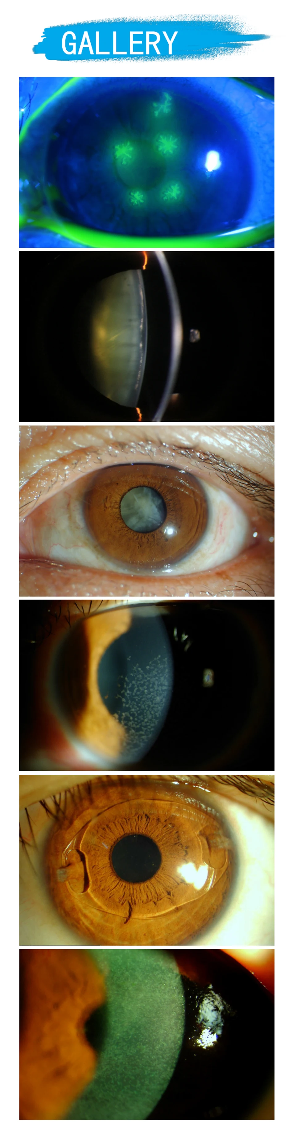 Five Magnifications Ophthalmology Slit Lamp Optometry Microscope with LED Illumination Optical Biomicroscope