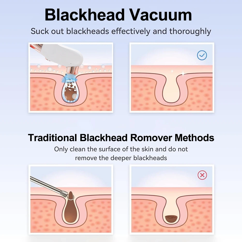 Electric Blackhead Remover Vacuum Facial Pore Cleaner Rechargeable Deep Dirt Skin Cleaning Machine for Pimple Blackhead Removal 3