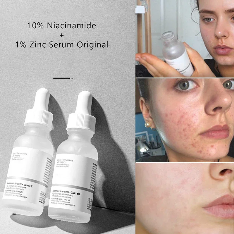 Niacinamide 10% + Zinc 1% Whiten Moisturize Essence High Strength Facial Serum Women Vitamin Mineral Blemish Formula Oil
