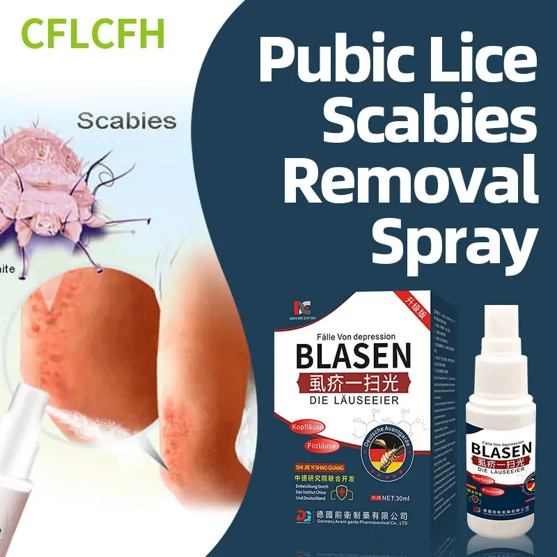 

Pubic Lice Scabies Treatment Spray Head Lice Eggs Remover Antibacterial Anti-Itching Mites Removal German Secret Recipe Medicine