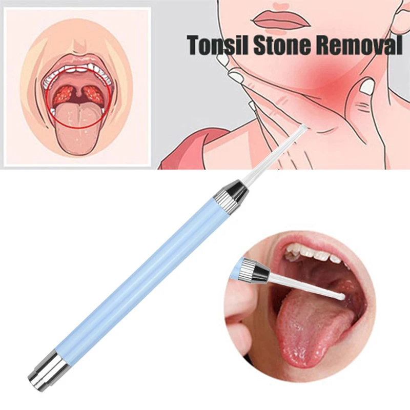 Luminescence Tonsil Stone Removal Ear Wax Remover Tool Mouth Cleaning Care Tools Tonsil Stone Remover Health Care tonsil stone remover