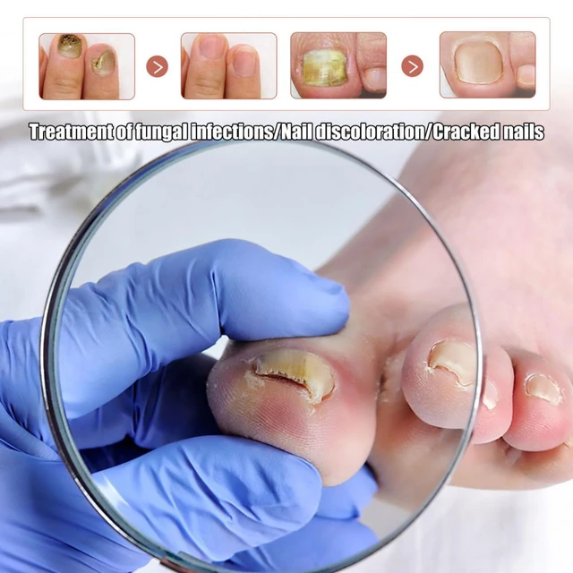 221 Finger Infection Treatment Home Stock Video Footage - 4K and HD Video  Clips | Shutterstock