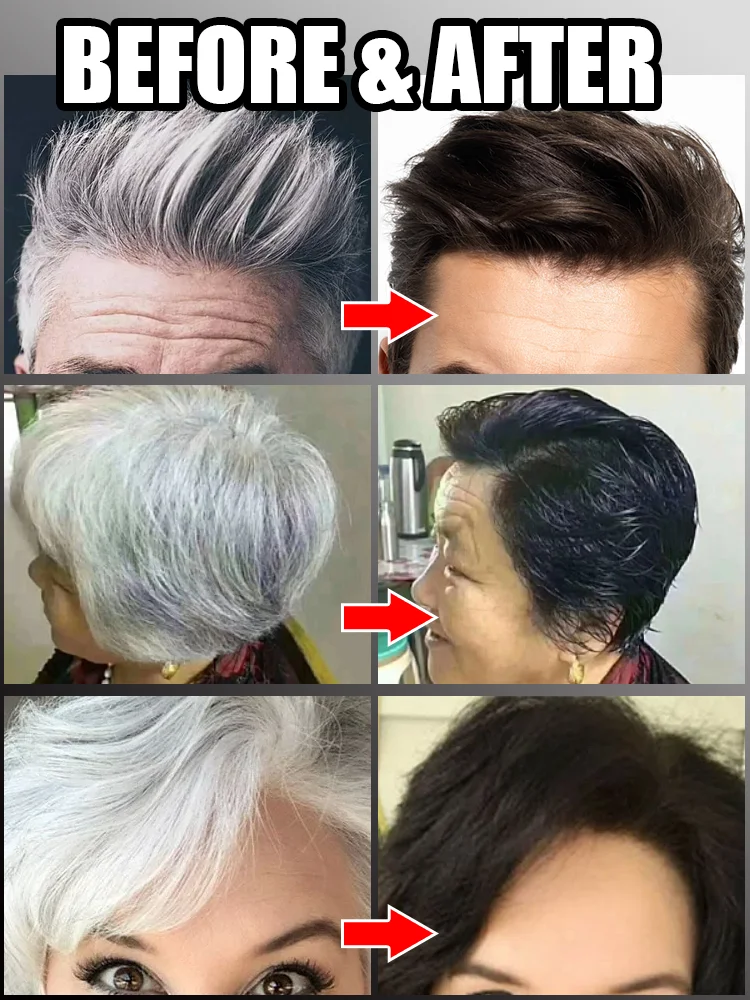 Gray Hair Killer Remove Gray Hair and Restore Original Color in 7 Days! hair color restorer