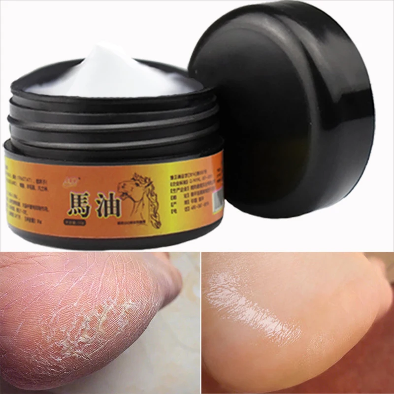 

30g Horse Oil Foot Cream Dead Skin Remover Fast Repair Foot Skin Care Moisturizing Anti-Drying Crack Strong Effective Cream