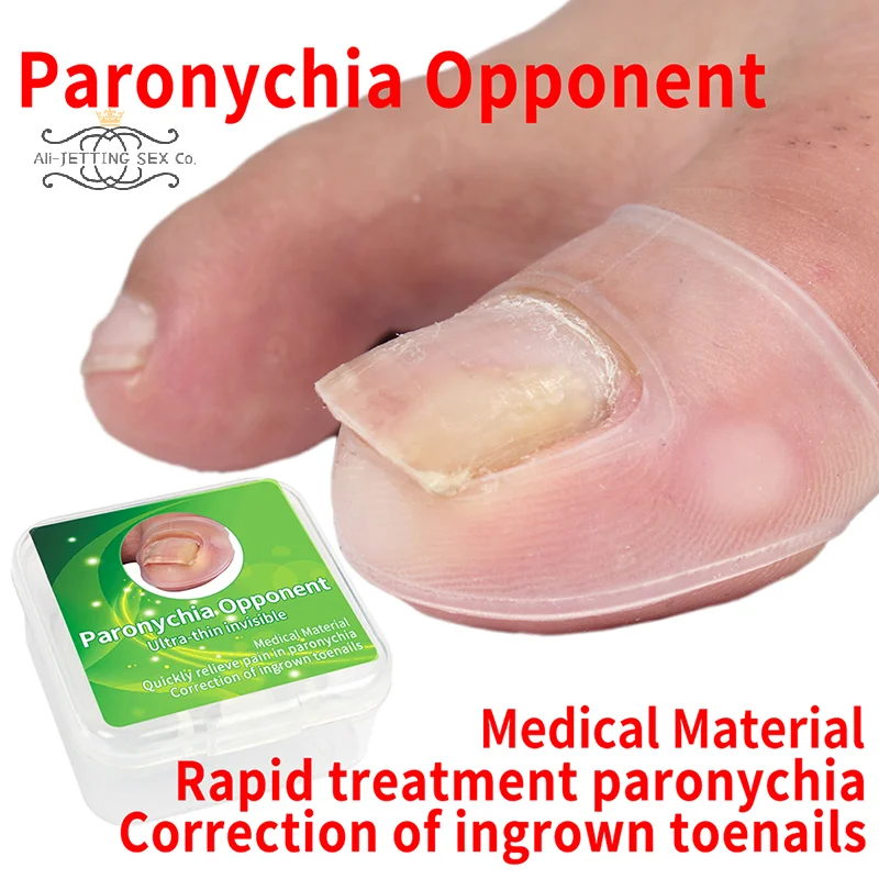 

Silicone Ingrown Toenail Correction Tool Invisible Ingrown Toe Nail Treatment