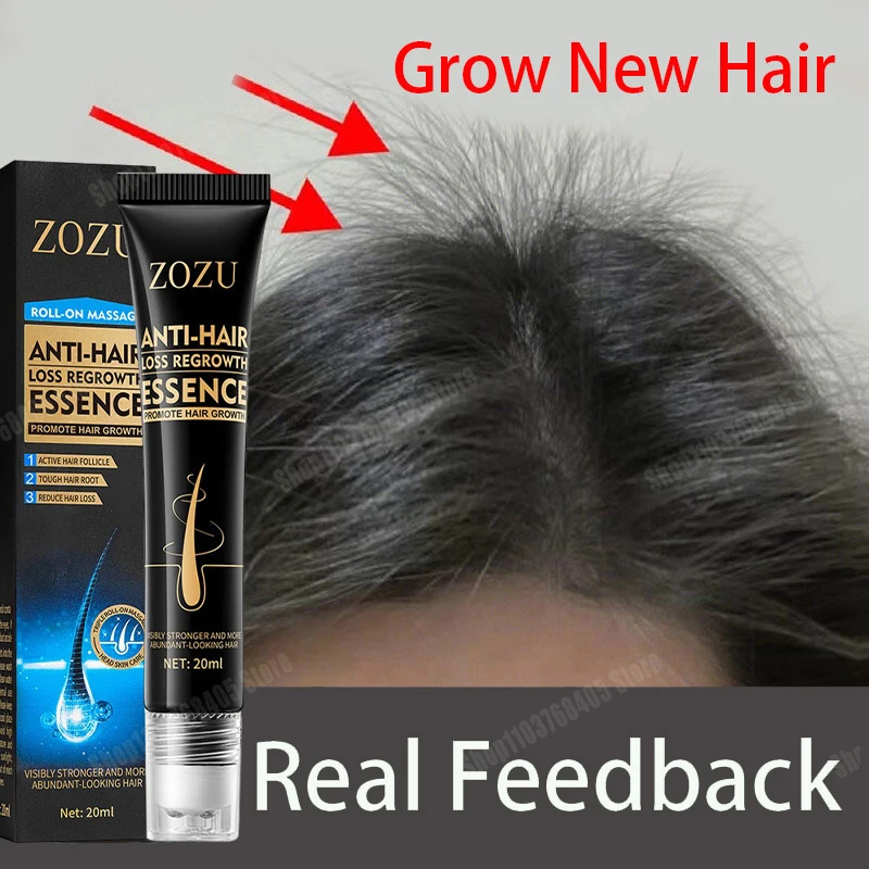 Fast Hair Growth Essence Effective Anti Hair Loss Serum Baldness Repair Hereditary Postpartum Seborrheic Loss oil Care