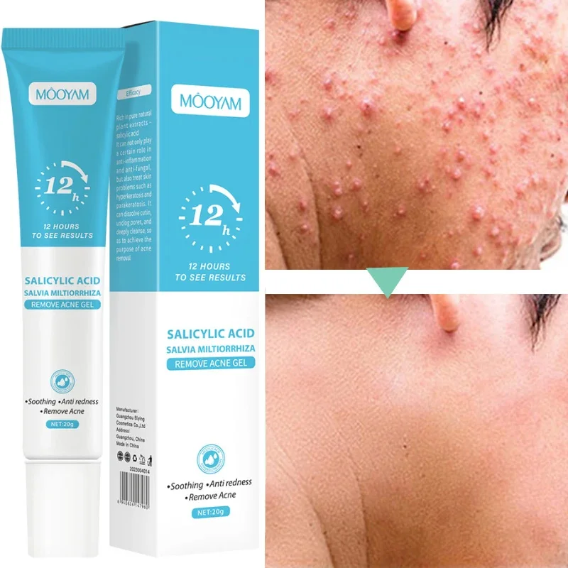 

Acne Treatment Face Cream Natural Anti Pimple Spots Scar Removal Gel Oil Control Shrink Pores Moisturizing Repair Skin Care