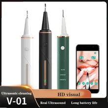 

Visible Dental Scaler Tooth Cleaner Ultrasonic Tartar Calculus Stain Remover Visible Teeth Whitening Oral Care Dental Scaler