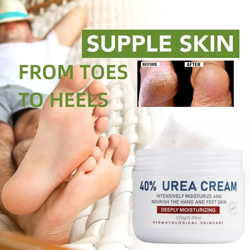 Urea Cream 40 Percent, Urea Foot Cream for Dry Cracked, 40 Per Urea Lotion for Feet Maximum Strength