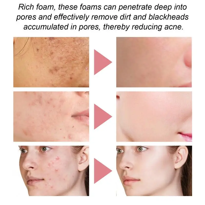 Facial foaming Cleanser Deeply Cleansing Oil Control Moisturizing Blackhead Removal Skin Care Face Wash Foam Cleanser 6