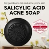 VIBRANT GLAMOUR Salicylic Acid Acne Handmade Soap Cleanses Pores Inhibits Acne Anti-Inflammatory Soothing  100g 2