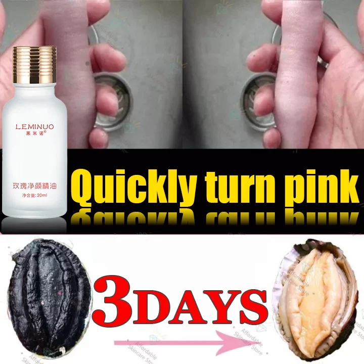 

Whitening Serum Cream Lighten Pigmentation Dullness Private Part whitening buttocks knees Elbows Inner Thighs