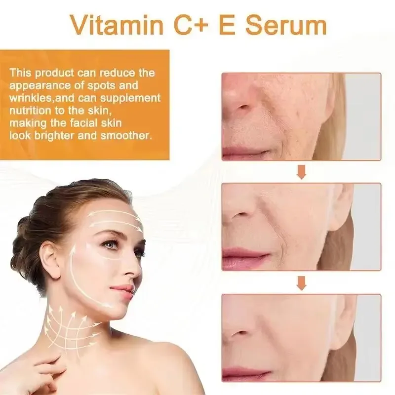 Vitamin C Whitening Serum Remove Freckles Dark Spots Face Essence Fade Melasma Melanin Brighten Repair Dull Skin Care Cosmetics 5