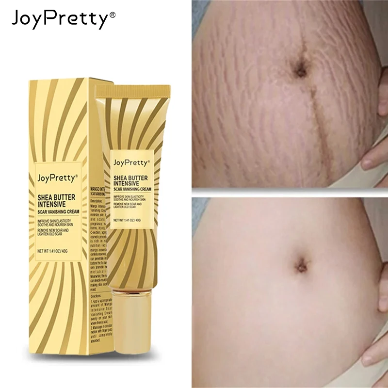 

Natural Herbal Scar Removal Cream Repair Pimple Scars Smooth Stretch Marks Burn Treatment Creams Whitening Skin Care