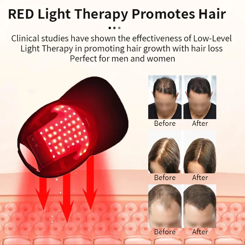 Red Light Treatment Hair Loss Laser Hair Regeneration Device Led Hair Rapid Growth 650nm Hair Care Relaxation 110g 0 001g medical food halogen light laboratory rapid infrared moisture meter grain moisture analyzer