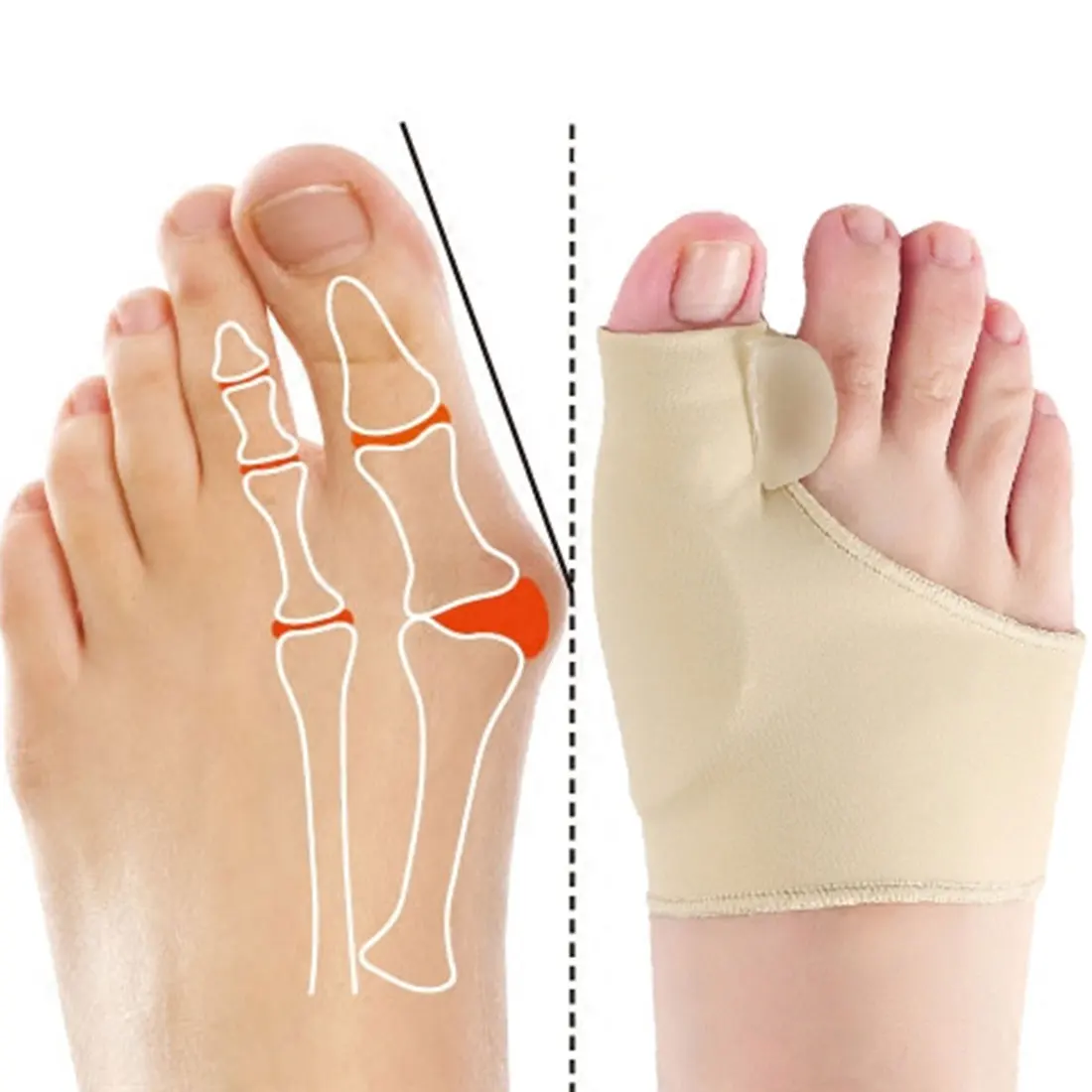 2Pcs=1Pair Toe Corrector Orthotics Feet Foot Care Bone Thumb Adjuster