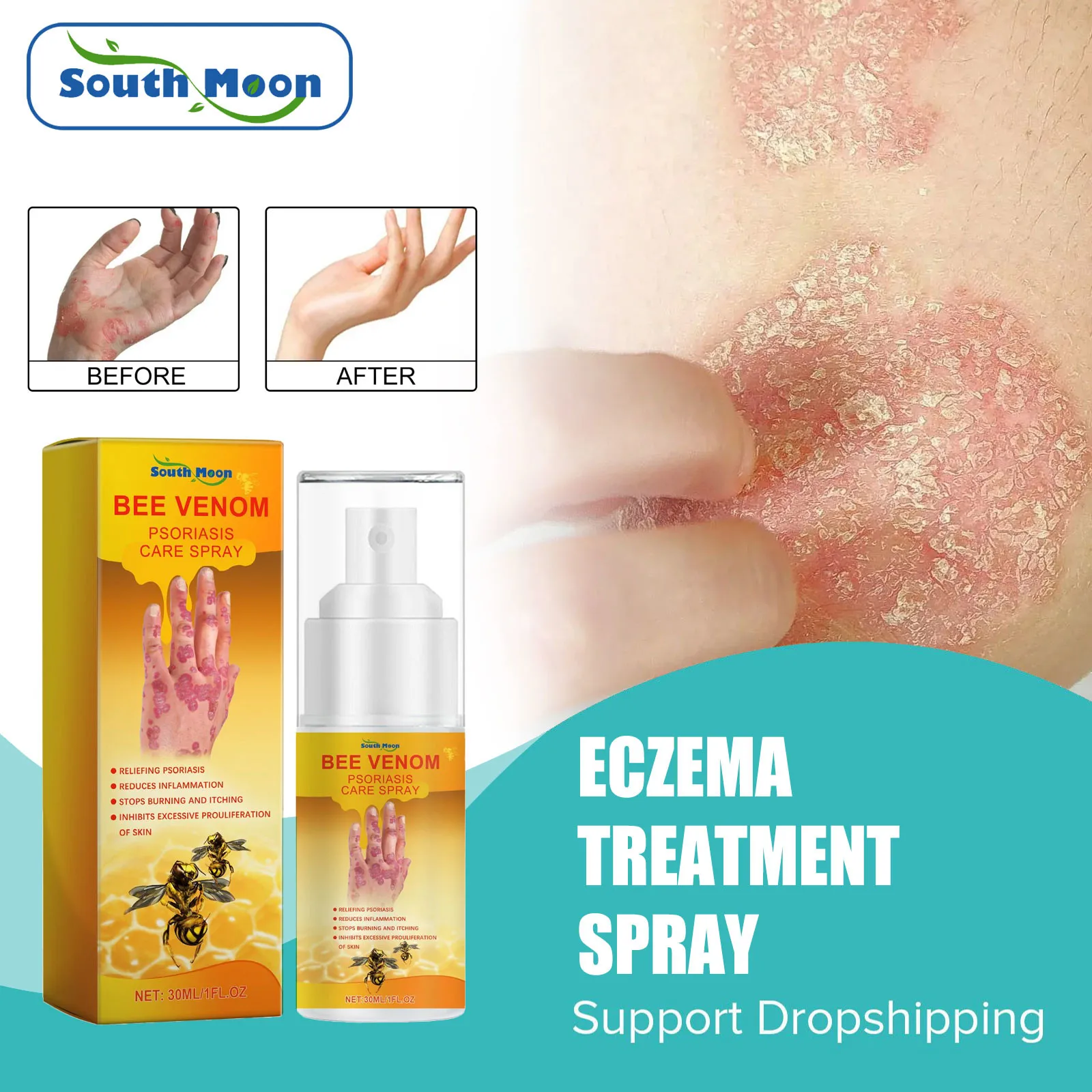 Seborrheic Dermatitis Spray Psoriasis Eczema Fungal Treatment Repair Itching Skin Redness Soothing Eczema Antibacterial Spray