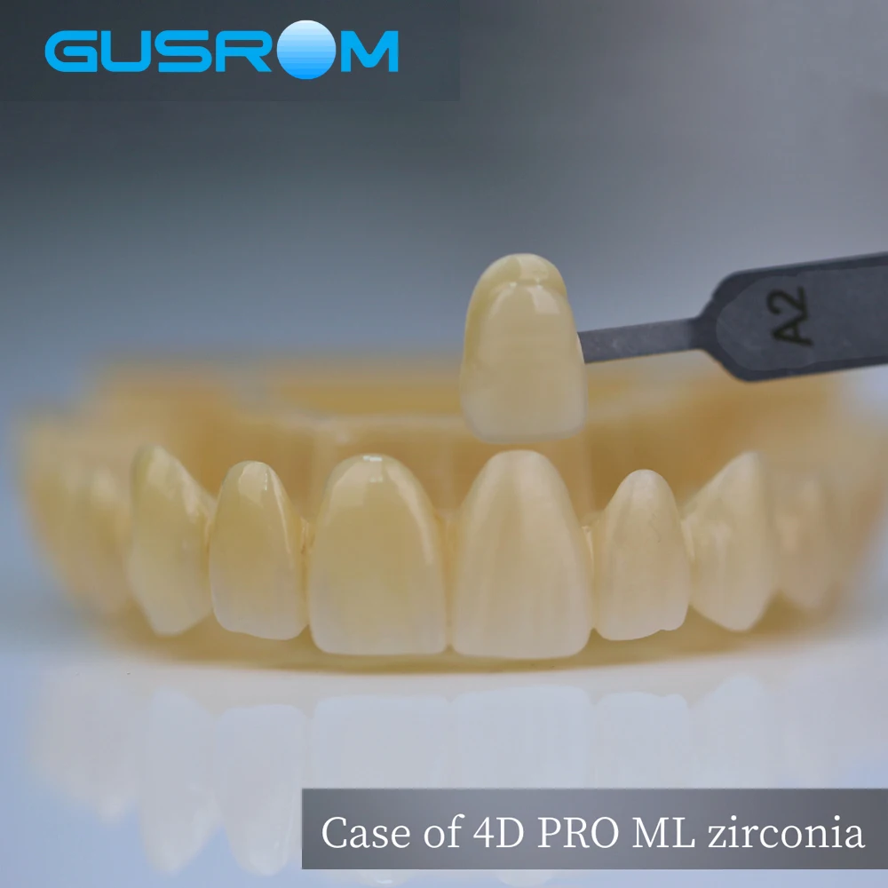 GUSROM 4D PRO ML Mehrschichtiger A3-Zirkonoxidblock 98 x 18 mm A2-Farbverlauf Hochtransluzente Dental- CAD-CAM-Zirkonoxidscheibe für Kronenbrücke – Detail 7