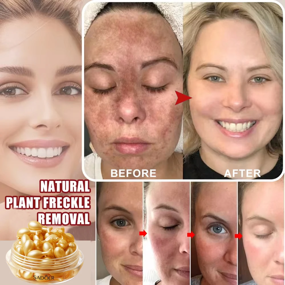 Whitening Serum Cream Fade Melanin Pigmentation Melasma Remove Dark Spots Anti aging Fade Fine Lines Brighten Korean Skin Care whitening body cream facial cream