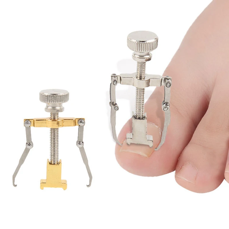 Correction of Paronychia with Toe Nail Correction Bracket for Treatment of Toe and Toe Care with Toe Fixator 2