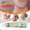 15g New Chinese Medicine Dermatitis Psoriasis Eczema Ointment Allergy Itch Skin Cream Skin Itching Lotion Herbal Anti-itch Cream