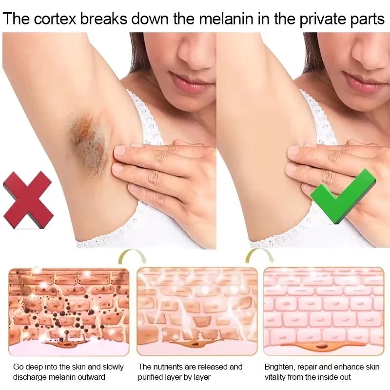 Body Whitening Cream Arms Thighs Underarm Knees Whitening Essence Cream Brighten Moisturizing Body Korean Skin Care Products